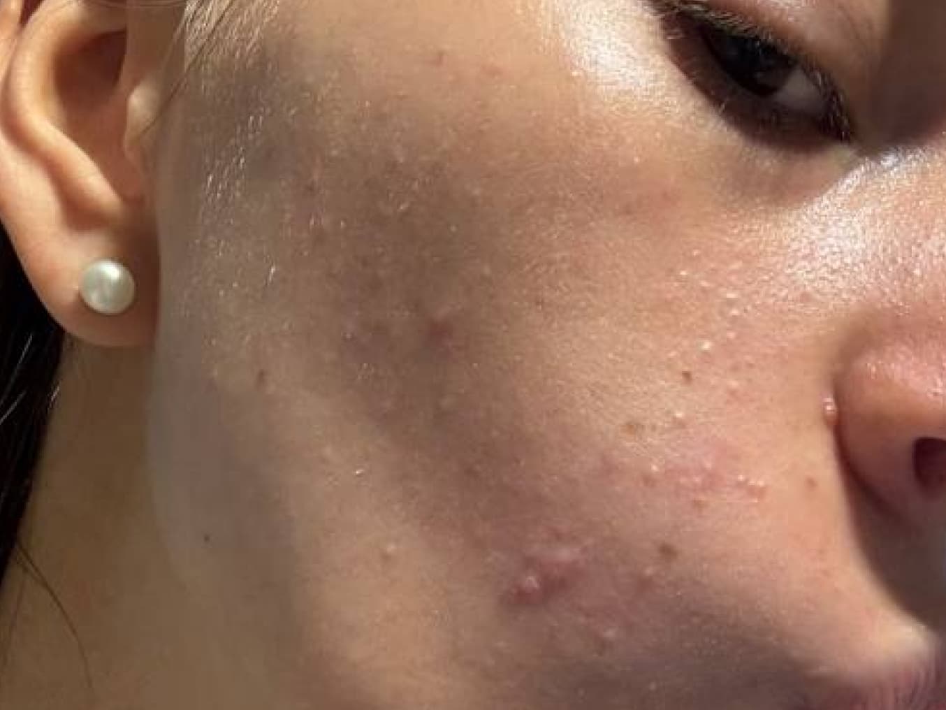 Yulia Hnatyshyn before Yulia Hnatyshyn before